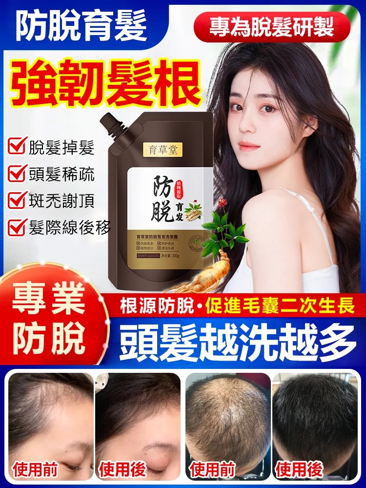 【育草堂防脫育發洗髮露】效果出類拔萃,眾多護髮品中的佼佼者。養髮,護髮,祛除頭皮上的角質,油脂,污垢。 【育草堂防脫育發洗髮露】效果出類拔萃,眾多護髮品中的佼佼者。養髮,護髮,祛除頭皮上的角質,油脂,污垢。